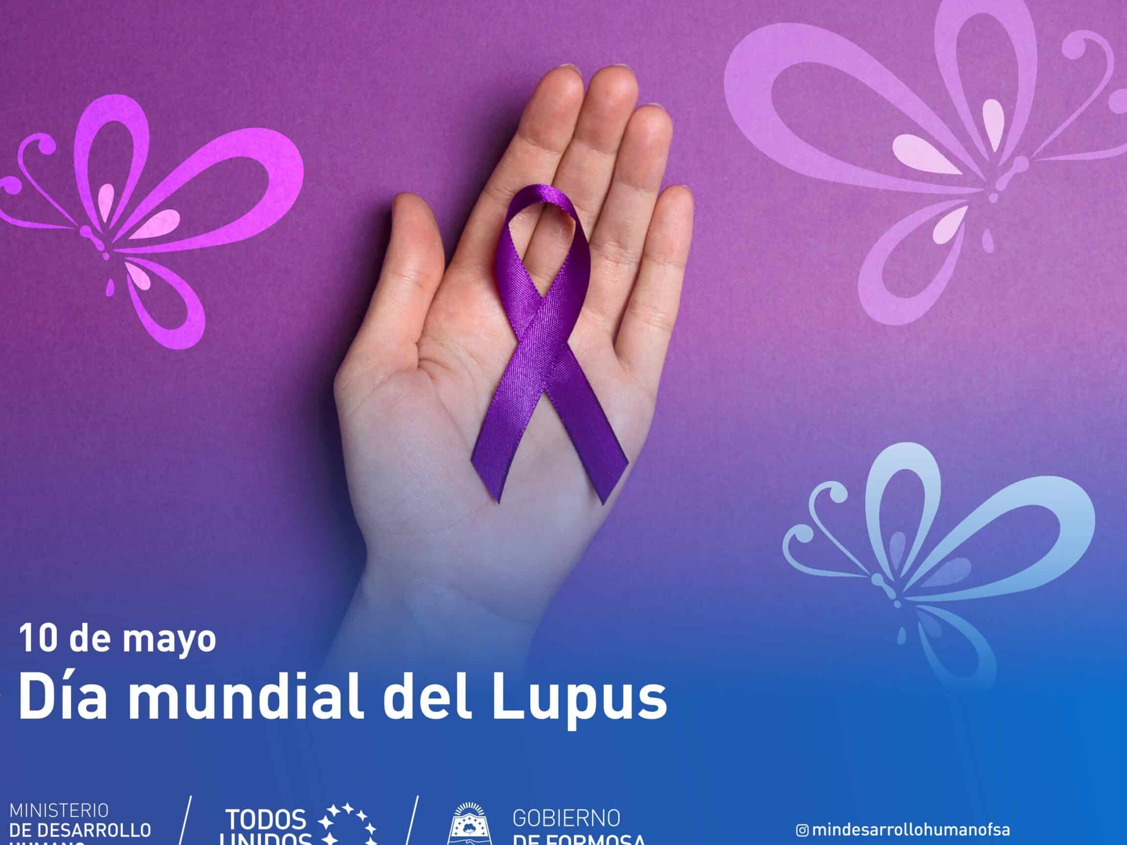 dia mundial del lupus 10 de mayo